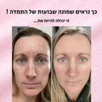 Face shaper pro - מכשיר לעיצוב הפנים